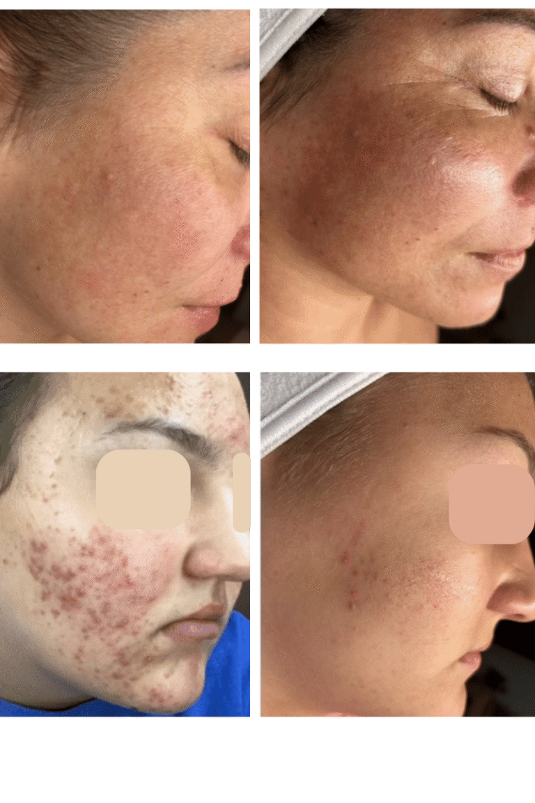 Real client before and after photos.
